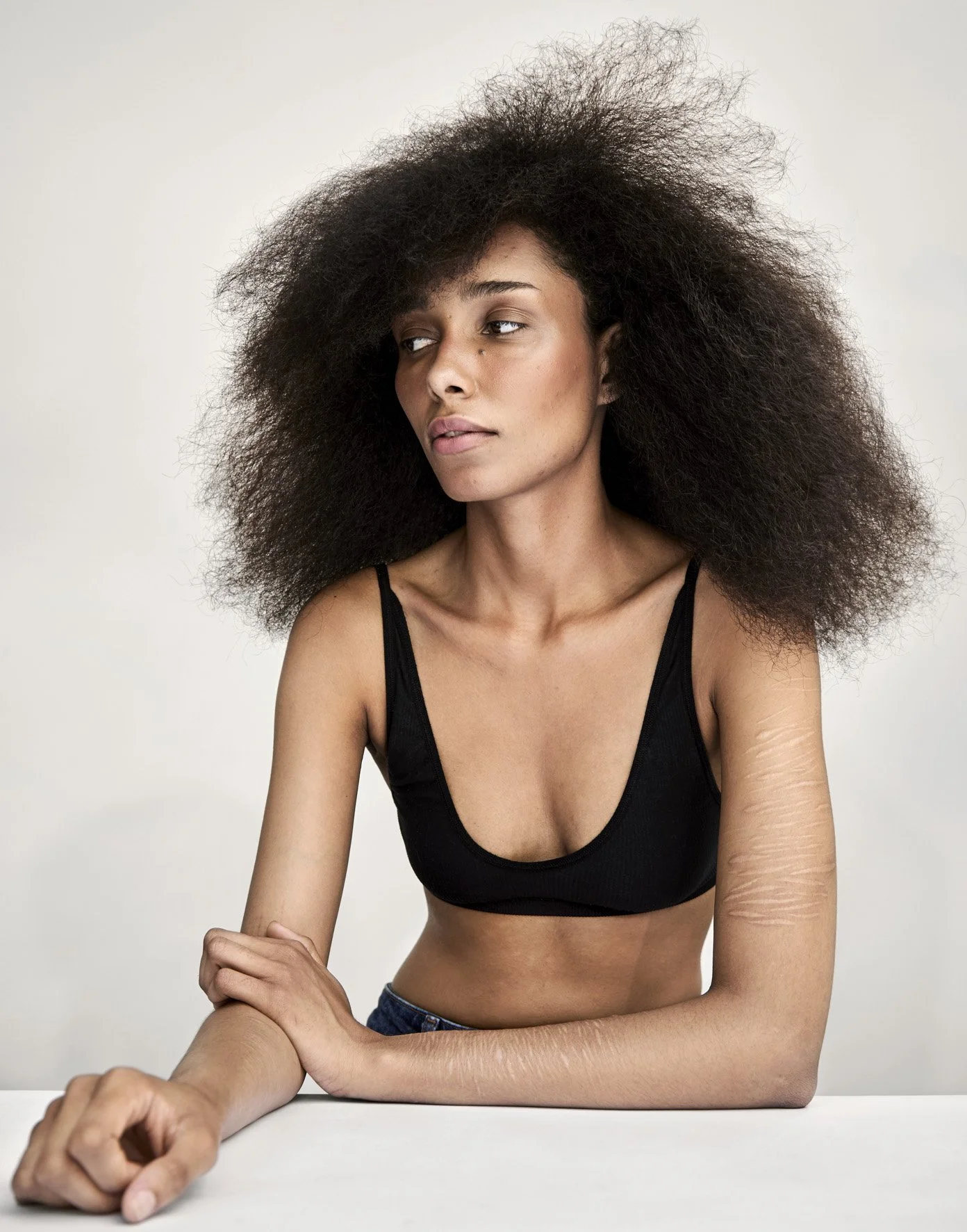 Colour portrait of Mia from The Skin Project 2026 by Benjamin Kaufmann