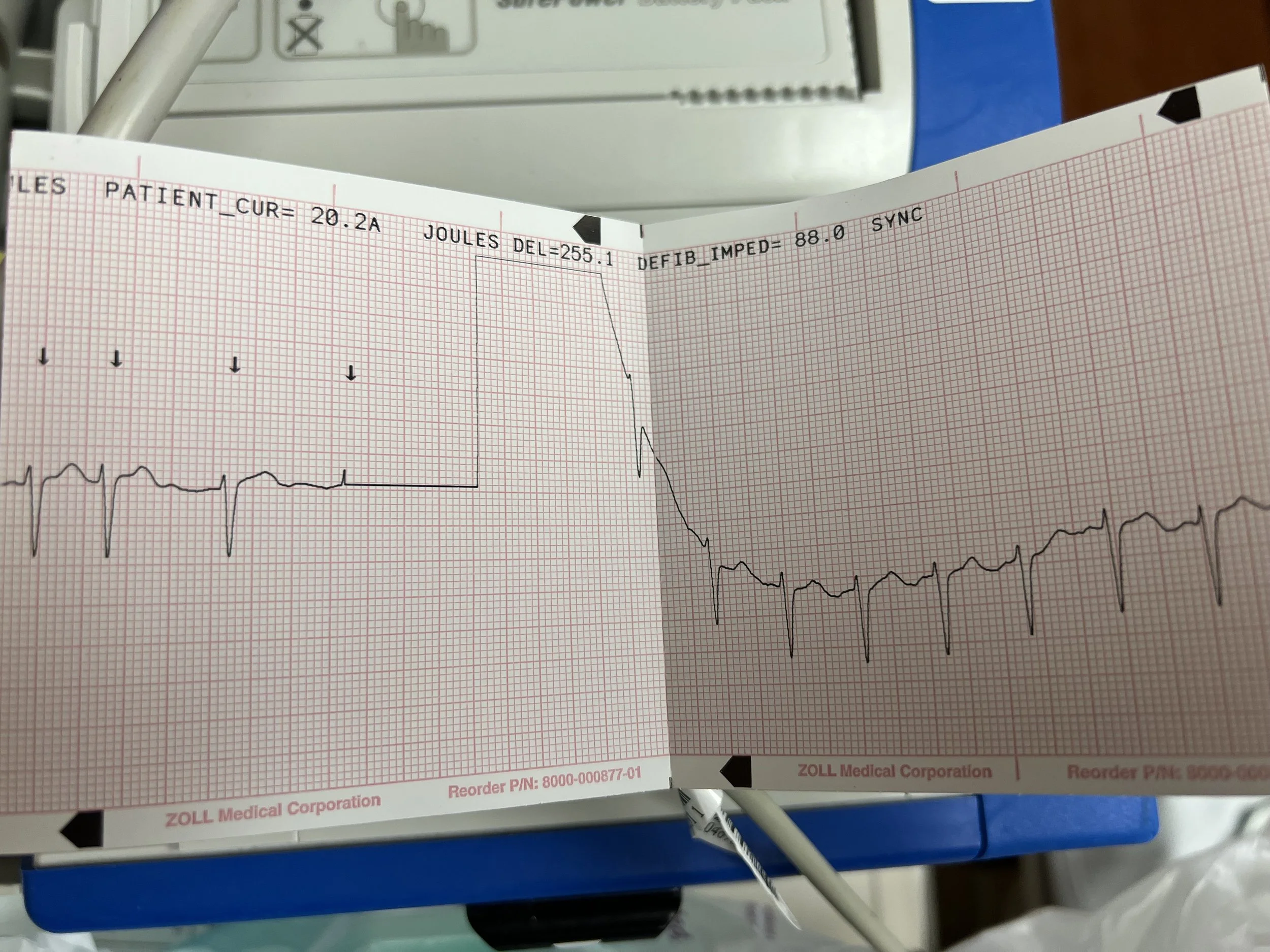 255 joules of electricity