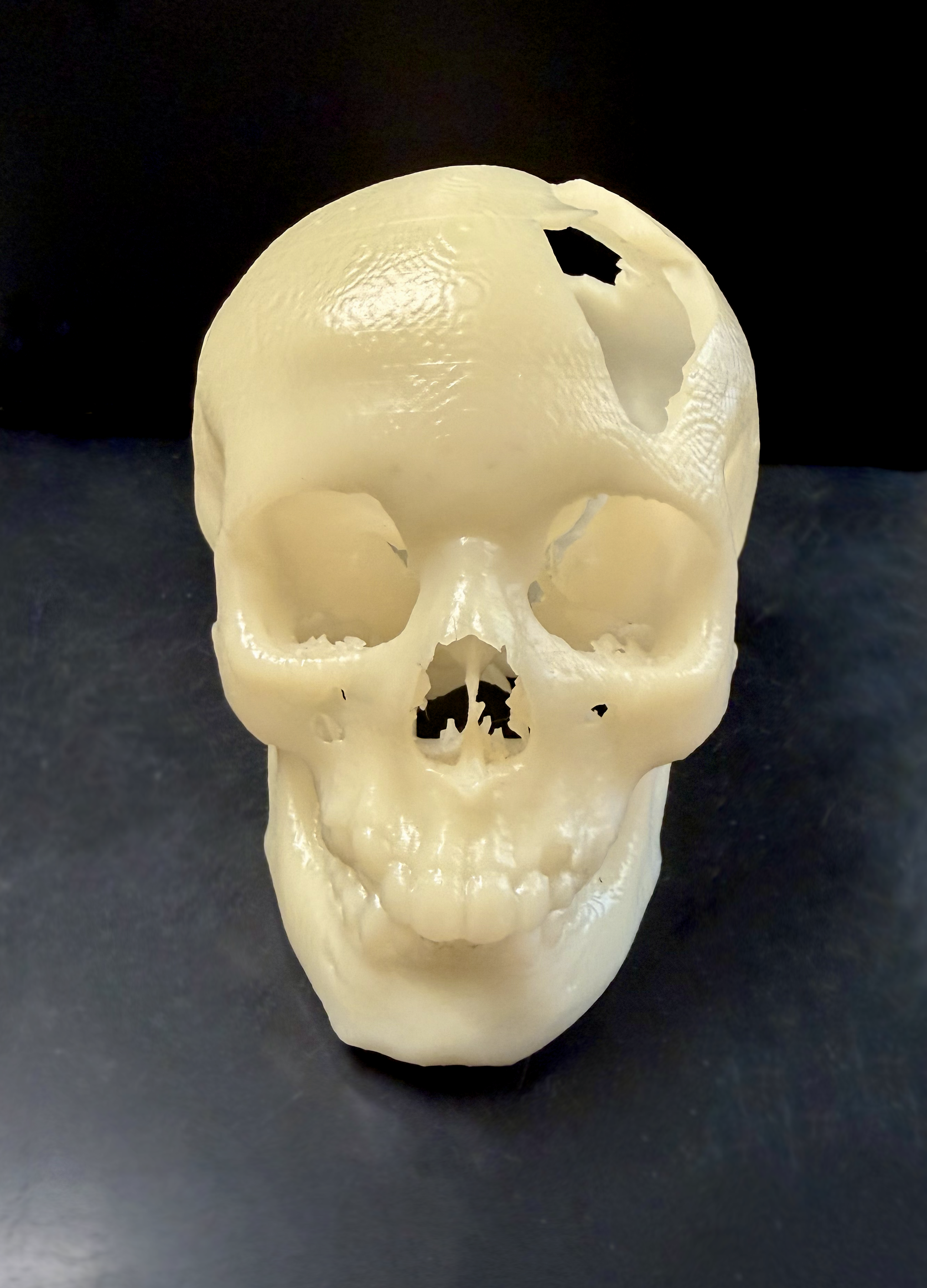 skull.png