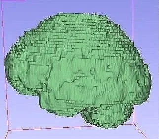 brain_cage.jpg