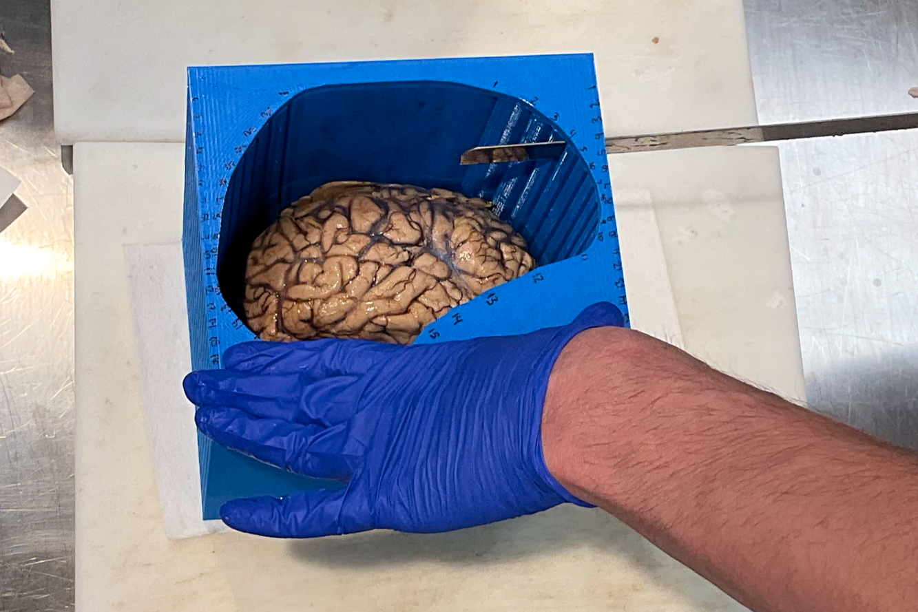 blue_brain.png