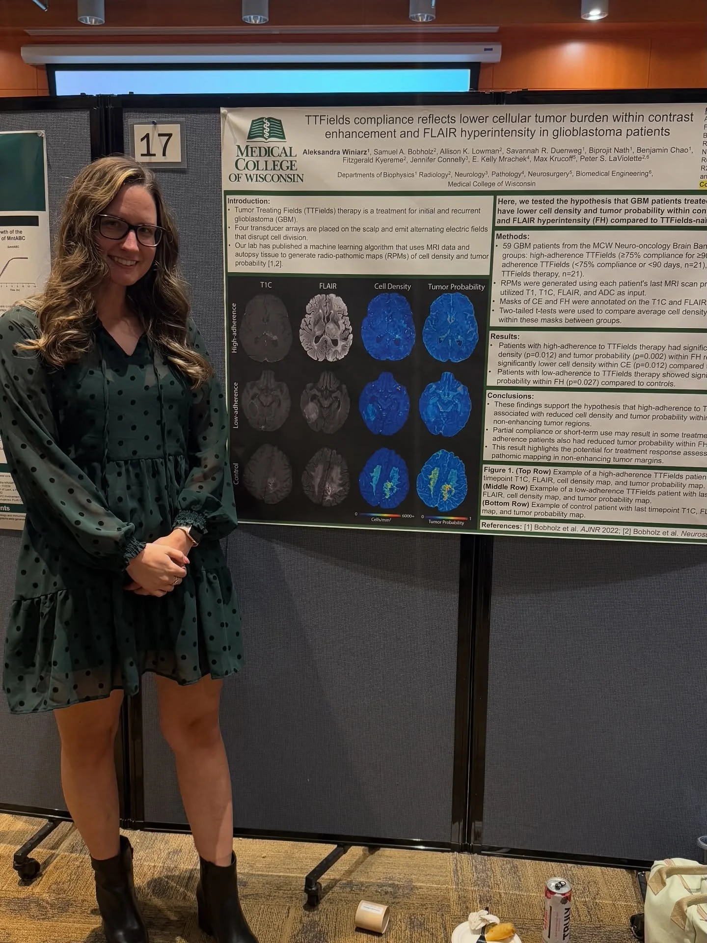 So proud of graduate students Aleks Winiarz, Ben Chao, and Biprojit Nath on their presentations at the Graduate School Poster Session this week!

The future of science is in good hands!! 🔬

#radiology #radiomics #radiopathomics #cancerresearch