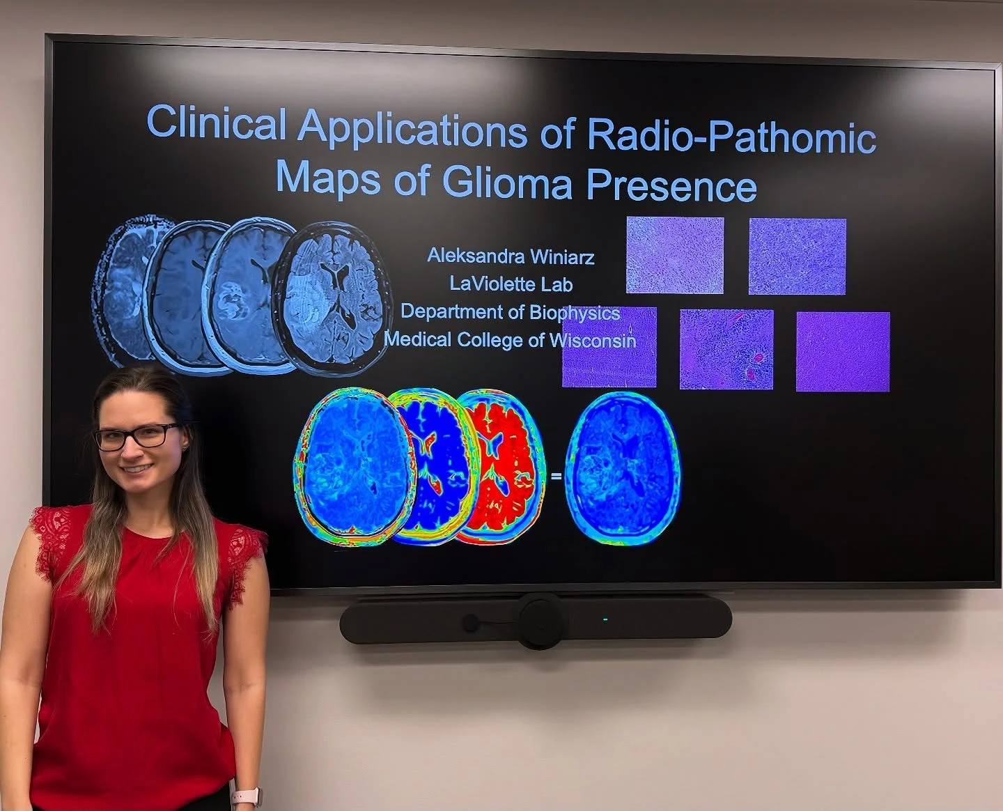 We are so proud of graduate students Aleks Winiarz and Biprojit Nath for their recent seminars with the Department of Biophysics and @mcwgradschool 🔬

#radpath #radiologyresearch #cancerresearch #radiology #pathology
