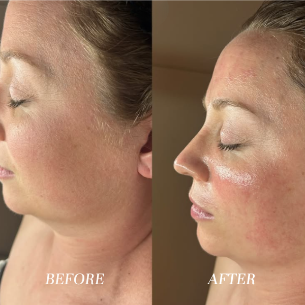 Glass facial with dermaplaning and peptide mask