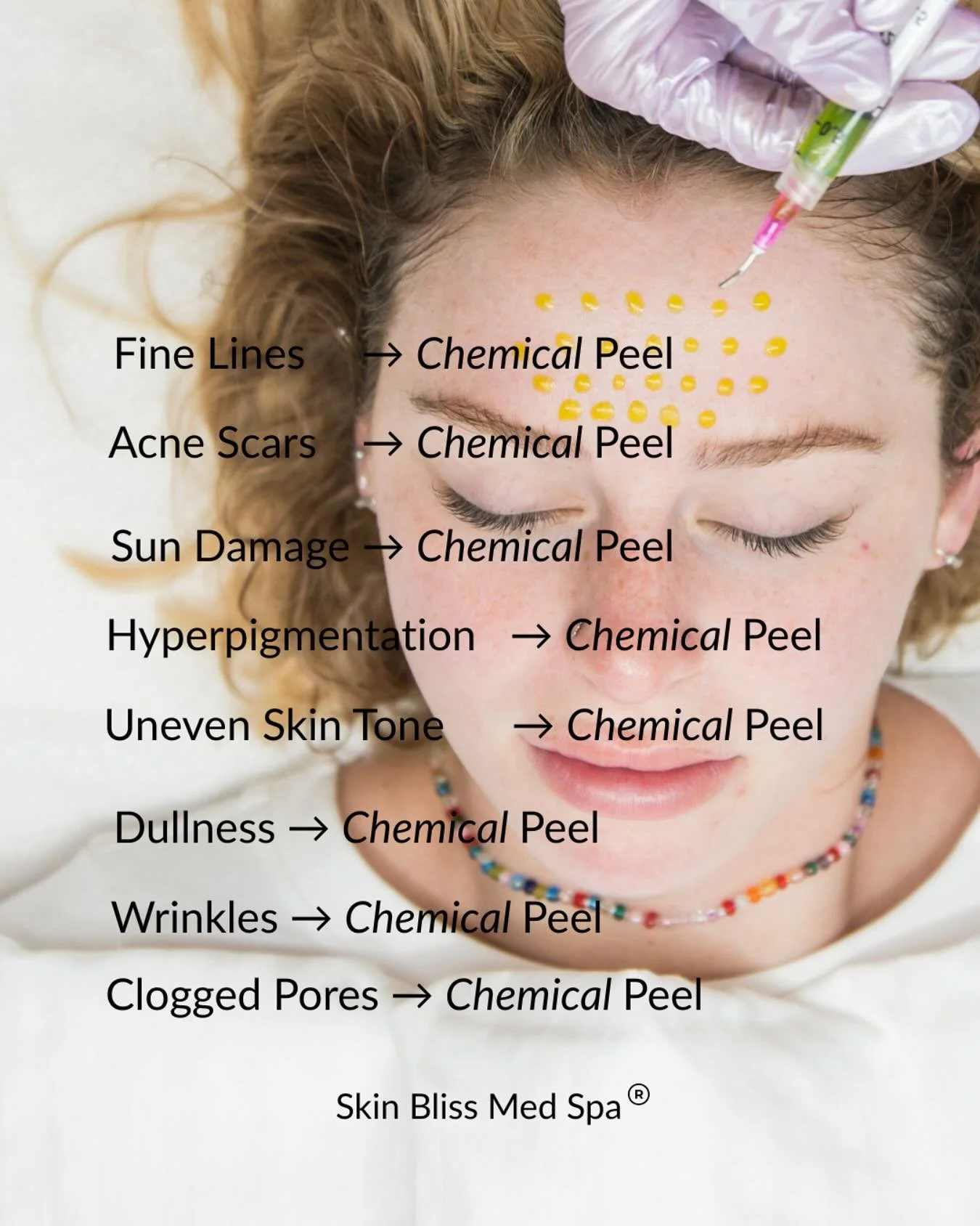 ✨ Think of chemical peels as a workout + medicine for your skin.
✔️ Like exercise, the more consistent you are, the stronger and healthier your skin becomes.
✔️ Like medicine, they repair, correct, and heal issues like acne scars, sun spots, wrinkles
