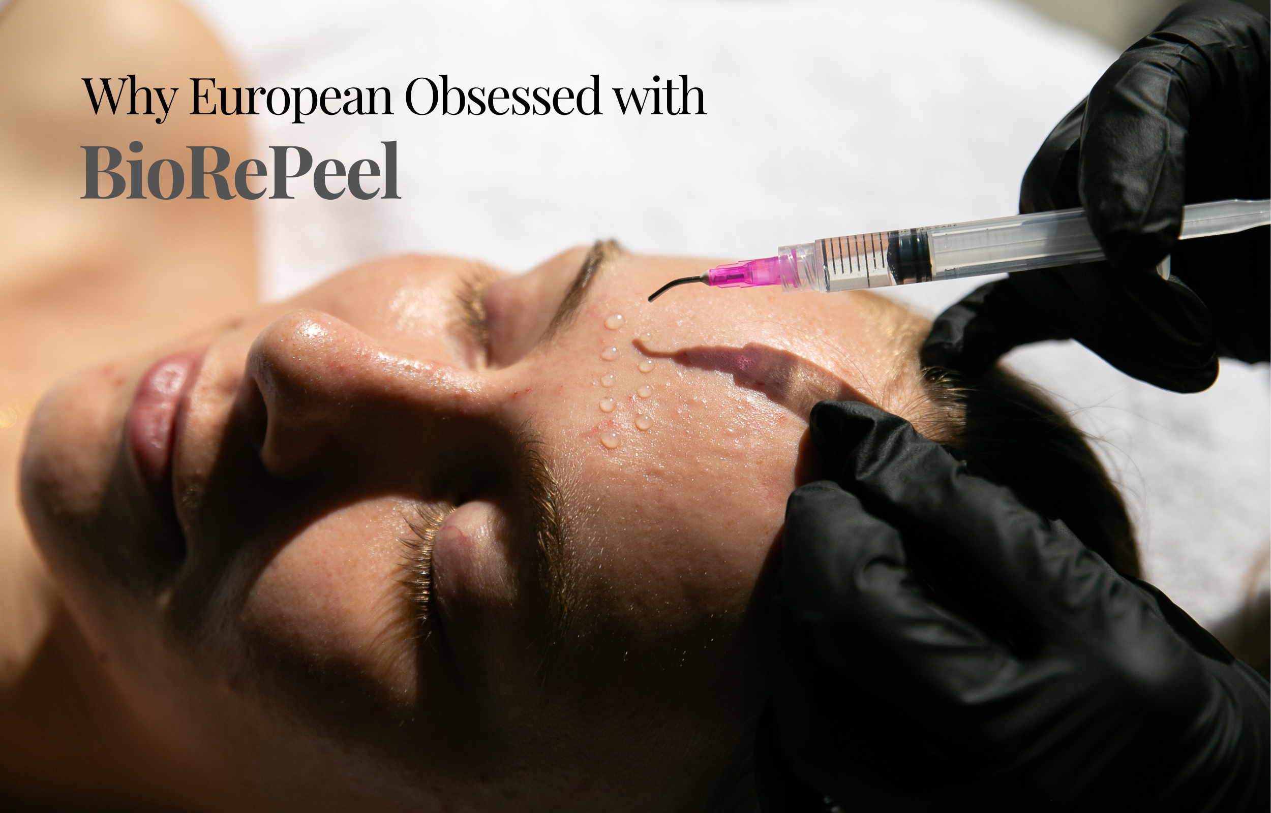 Why the BioRePeel Is the European Secret to Youthful, Healthy Skin