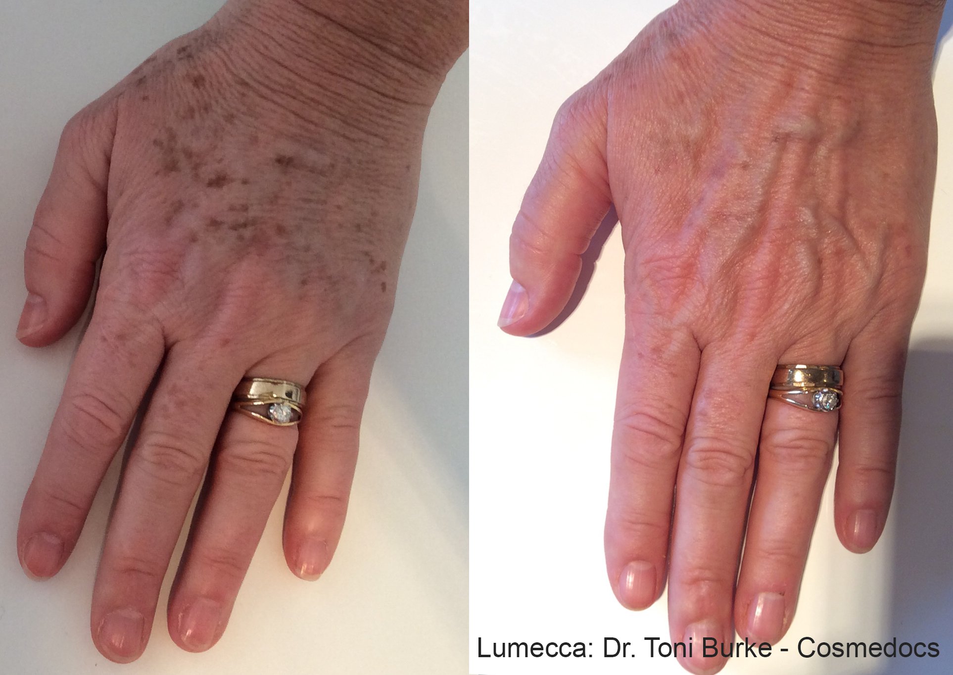 TB_Lumecca_1a_Hands (1).jpg