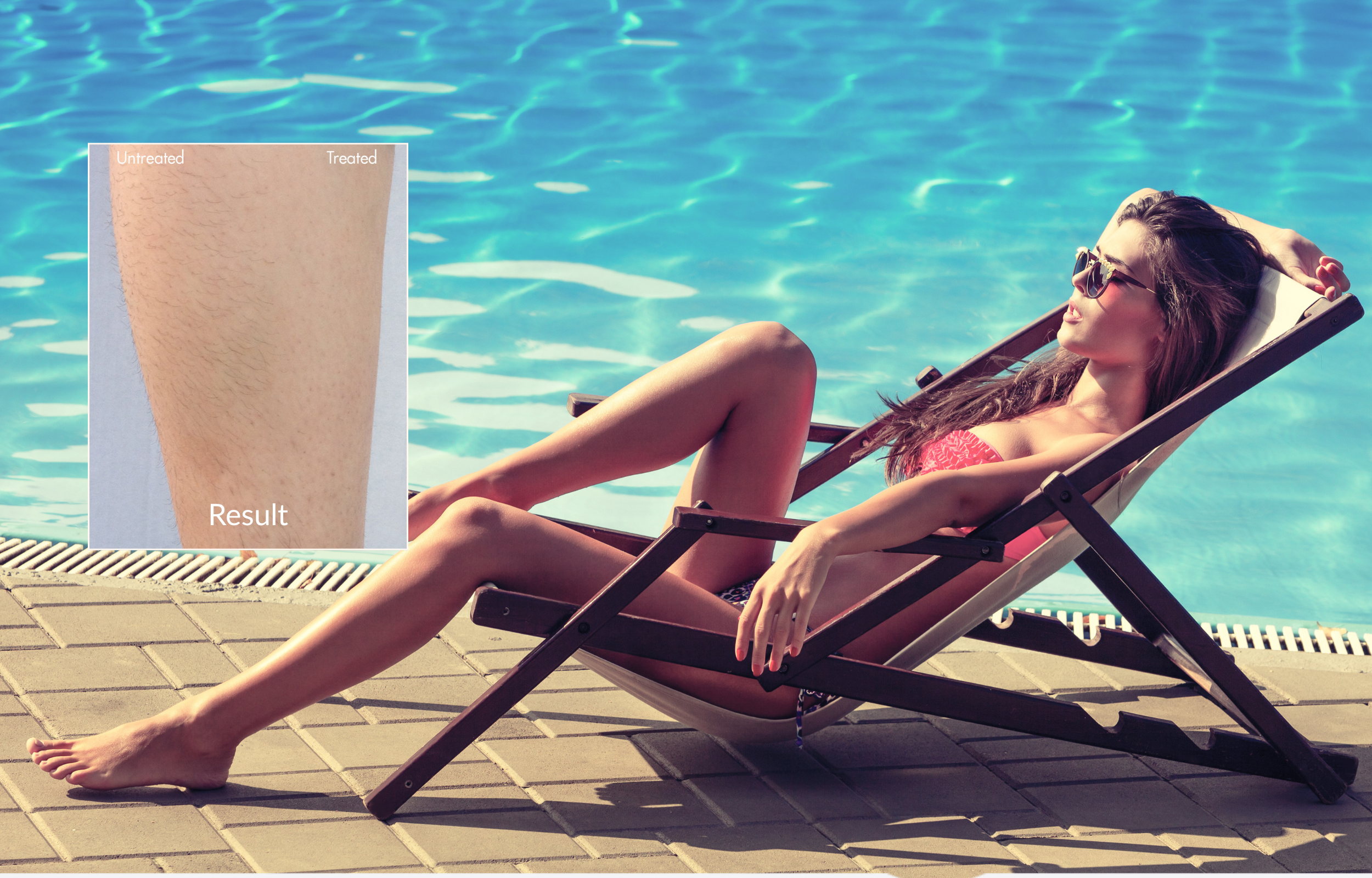 Laser Hair Removal: How it Works, Safety &amp; What to Expect