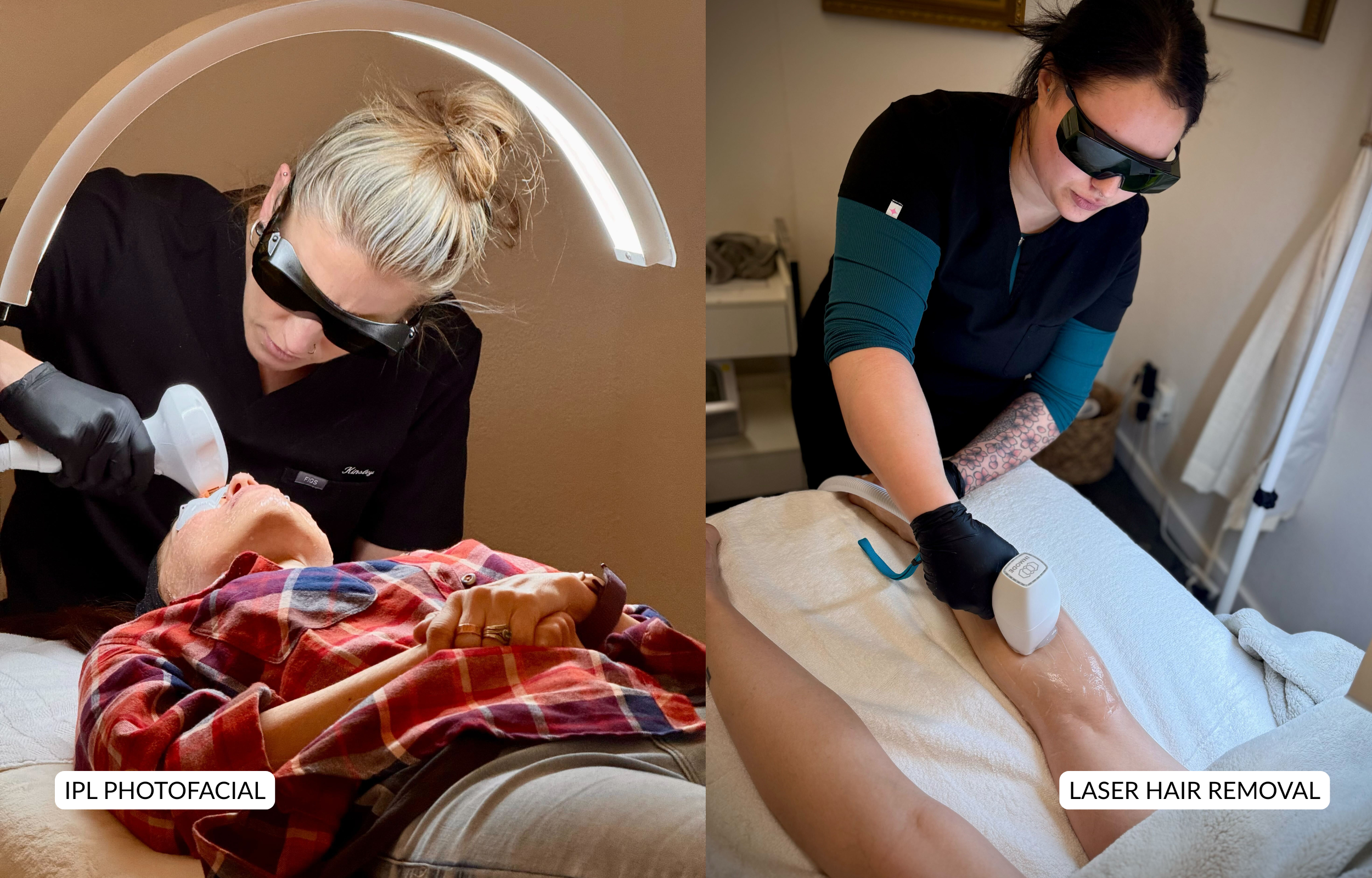 Laser Hair Removal vs IPL
