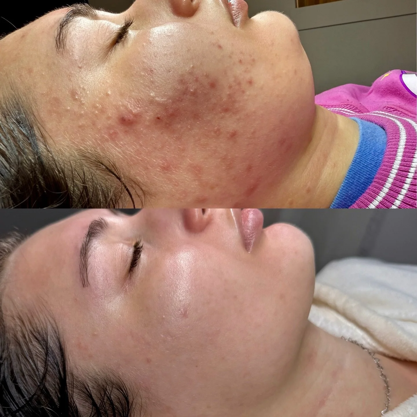 Just a lil reminder to stop and celebrate your progress. (in whatever goals you&rsquo;re working on) The finish line never really seems to arrive does it.. ? and even when it does, a new one always pops up ahead :) 

Take time to celebrate your wins,