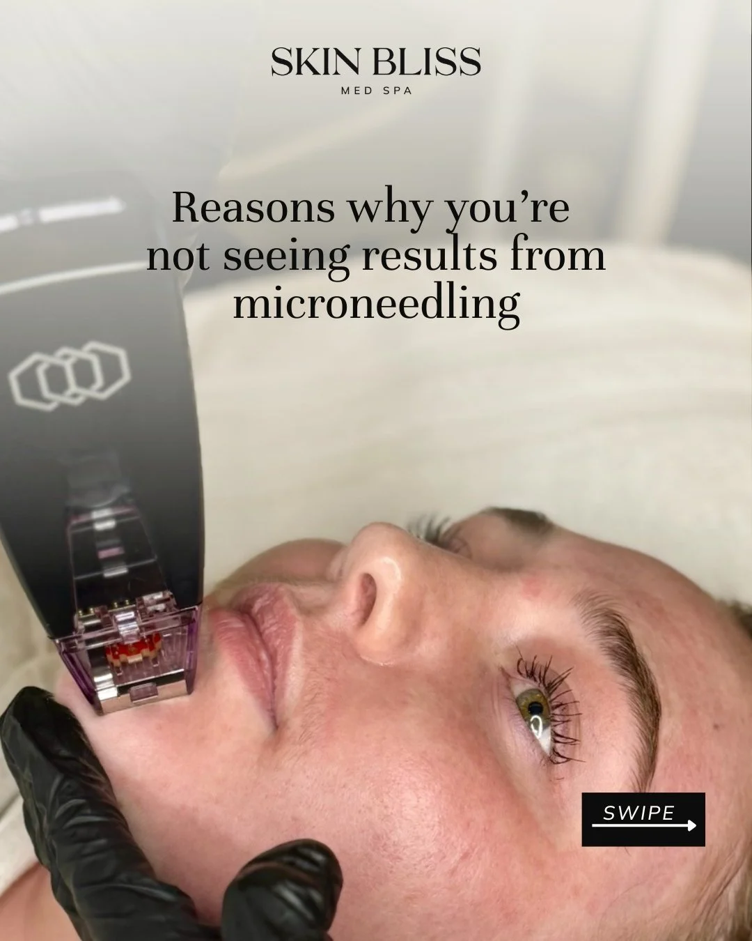 You've done microneedling. Maybe even multiple sessions. But the results? Not what you expected. 😤

Here's the thing, microneedling WORKS. But only when it's done right. Swipe through to see the most common reasons people don't see results (and yes,