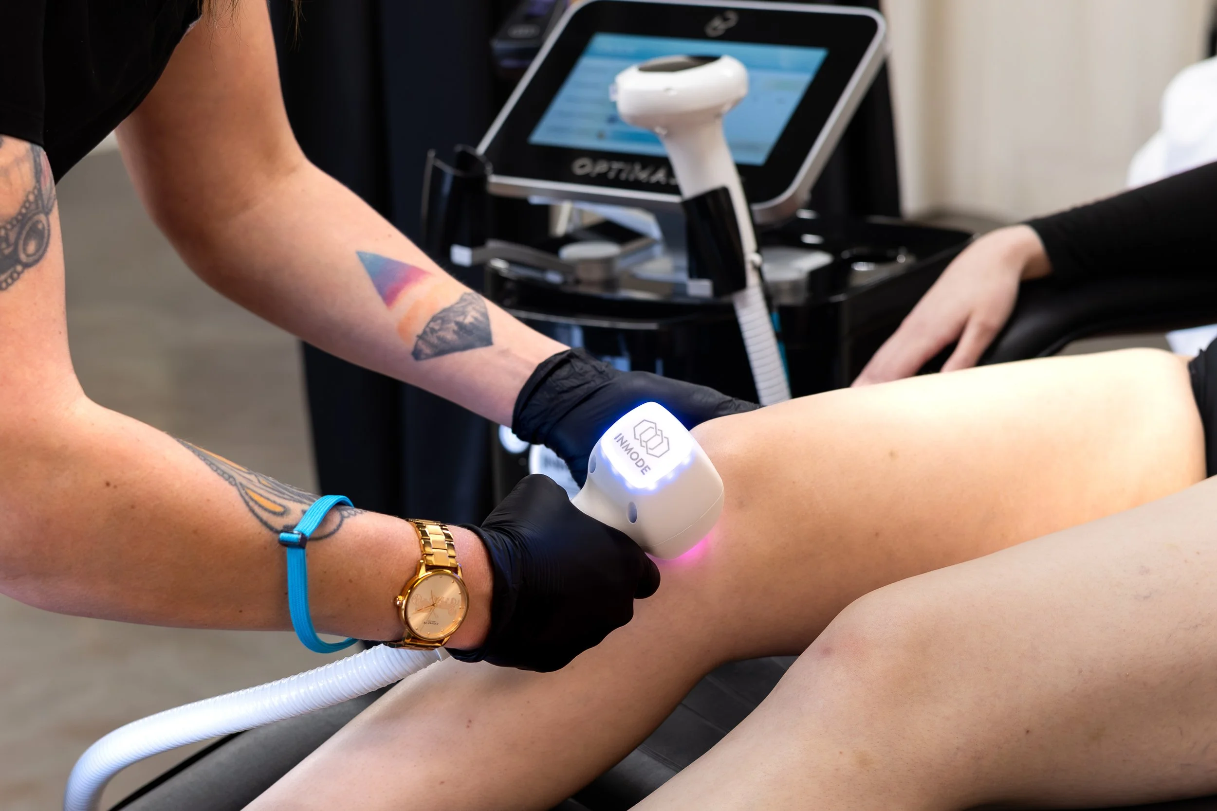 How Much Does Laser Hair Removal Cost in Helena, MT? (2026 Pricing Guide)