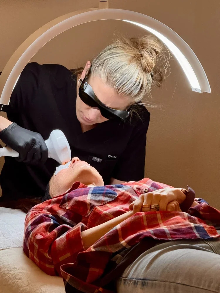 How Long Does It Take to See Results From IPL Brown Spot Removal?