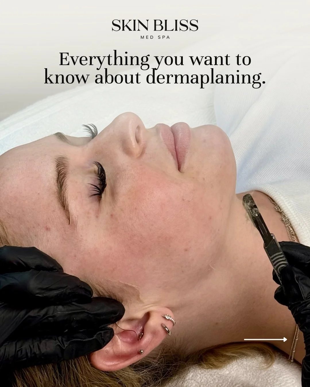 Everything you've been wanting to ask about dermaplaning, let's talk about it. ✨ 

Dermaplaning gently removes dead skin cells and peach fuzz, leaving your skin incredibly smooth and glowy.

And no, your hair won't grow back thicker or darker. 🤍
Cur