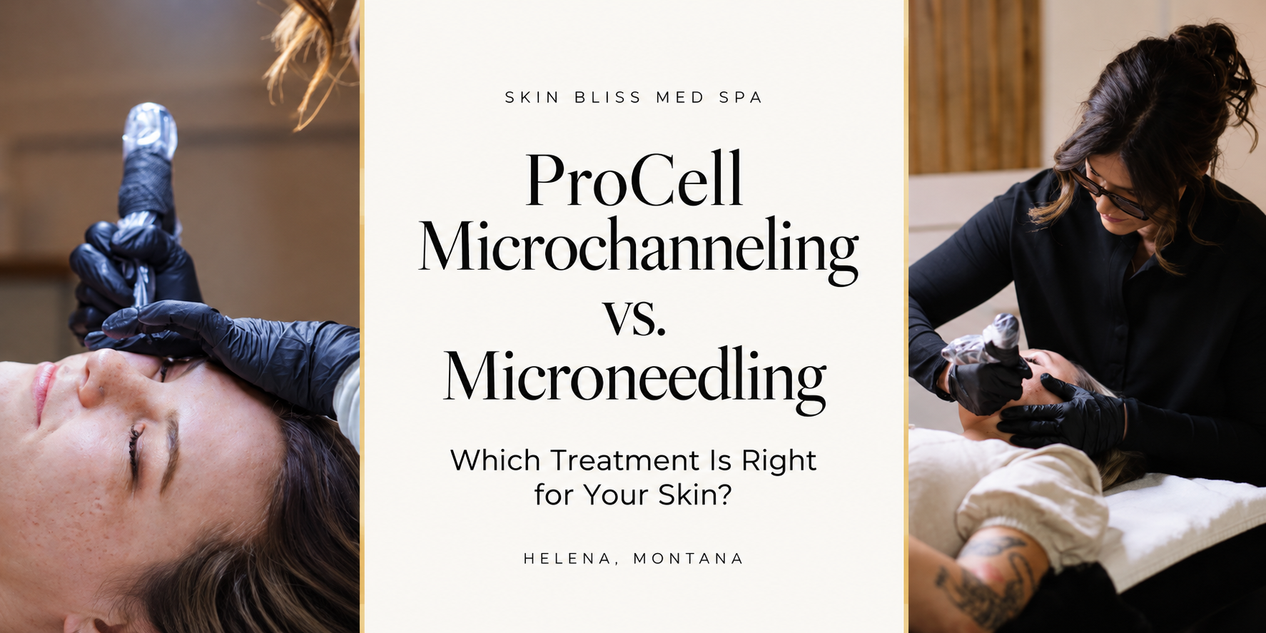 ProCell Microchanneling vs. Microneedling: Which Treatment Is Right for Your Skin?