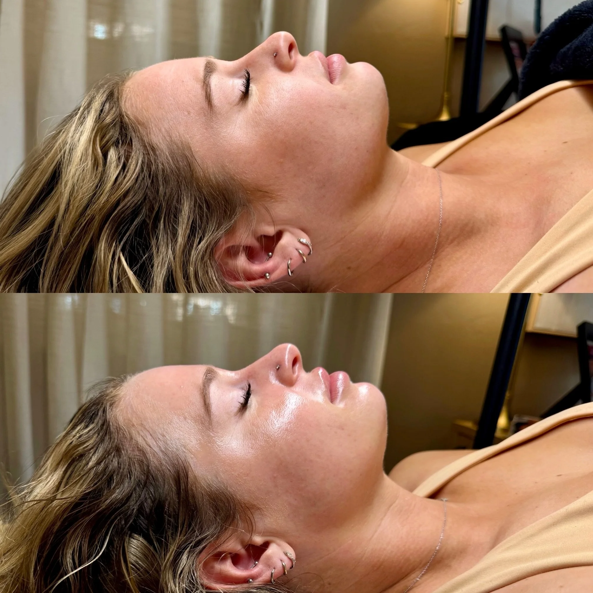 fresh glass skin facial 🪩✨ by @_skinblissbybrynne_