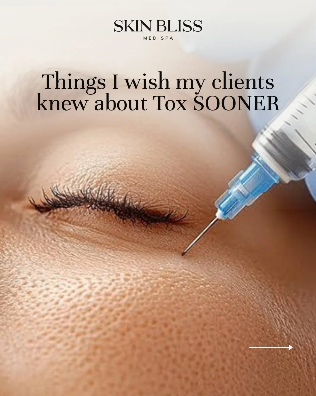 If you've been curious about Tox but weren't sure what to expect, start here.

Save this for the next time you're thinking about trying Tox, and let me know what you wish you had known sooner. ✨

📍 Skin Bliss Med Spa | Helena, MT

#tox #helena #inje