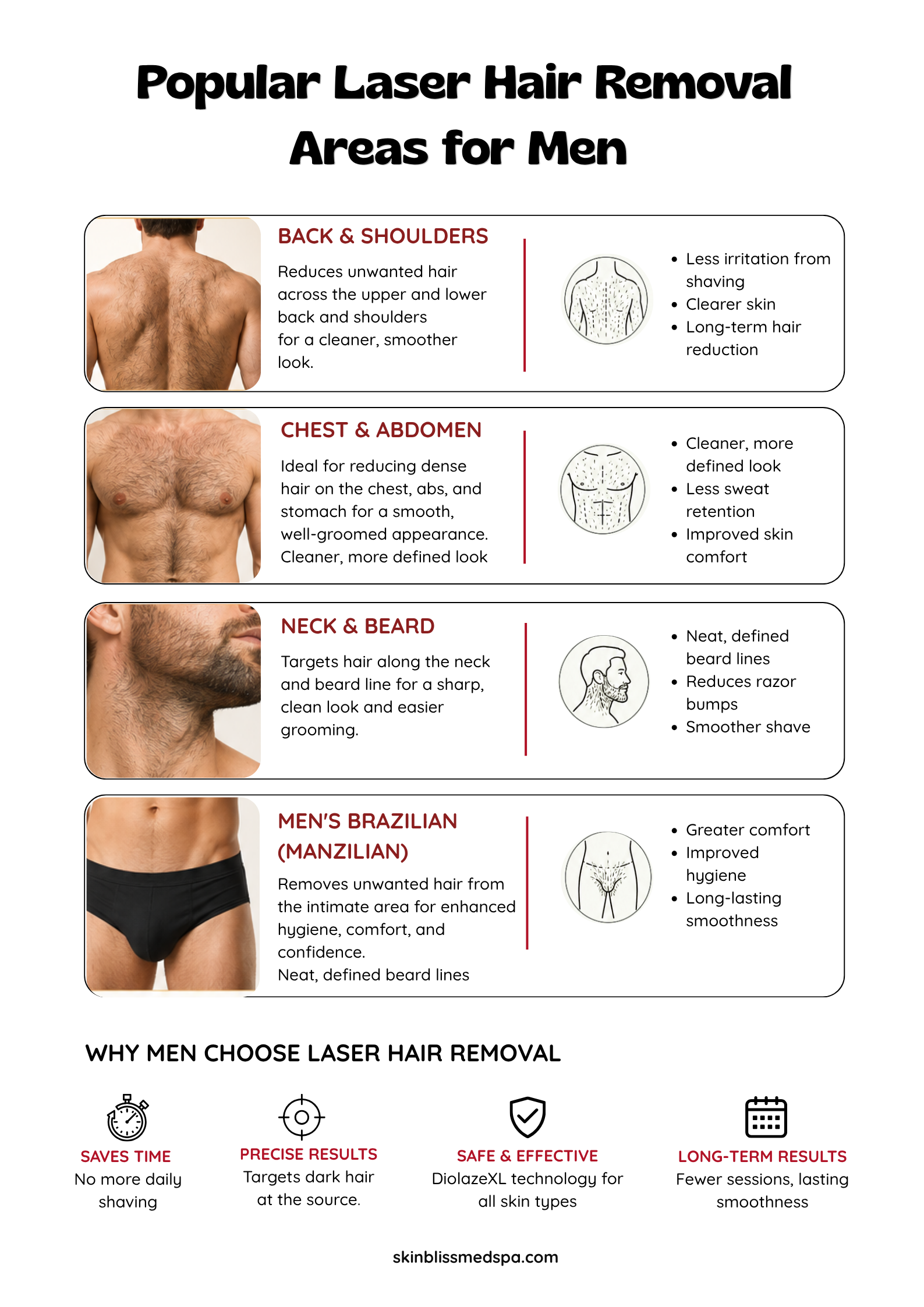 Popular Laser Hair Removal Areas for Men