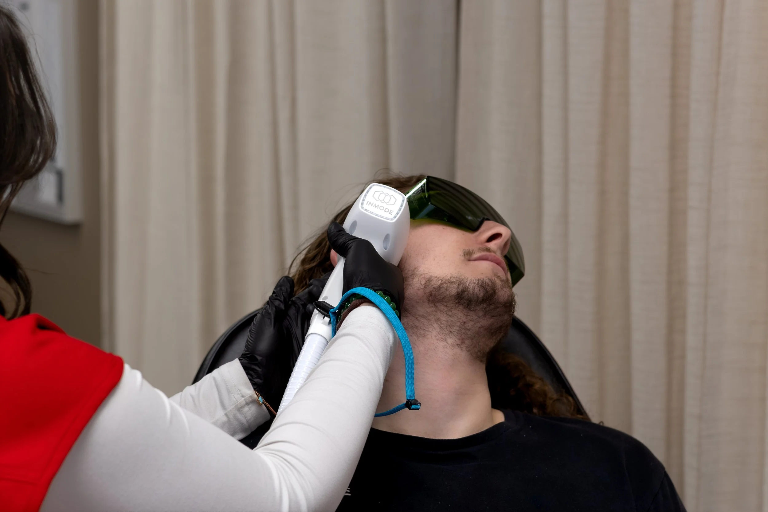 Sideburns Laser Hair Removal for Men and Women