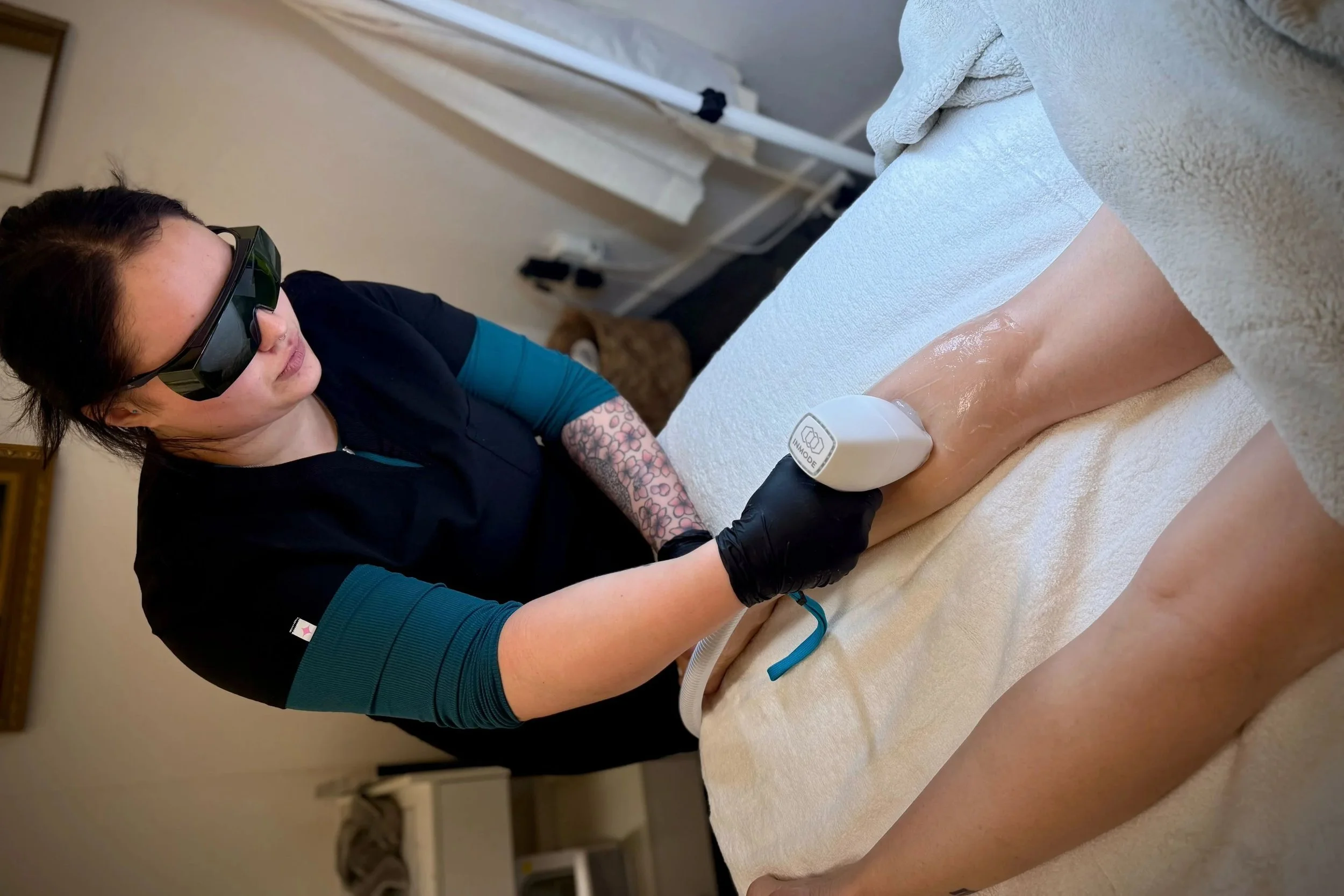 Laser Hair Removal
