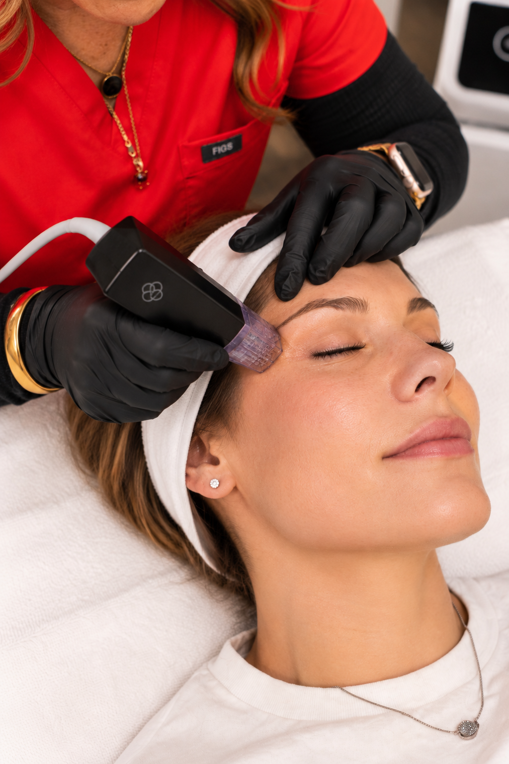 RF Microneedling for Eye Area in Helena, MT.