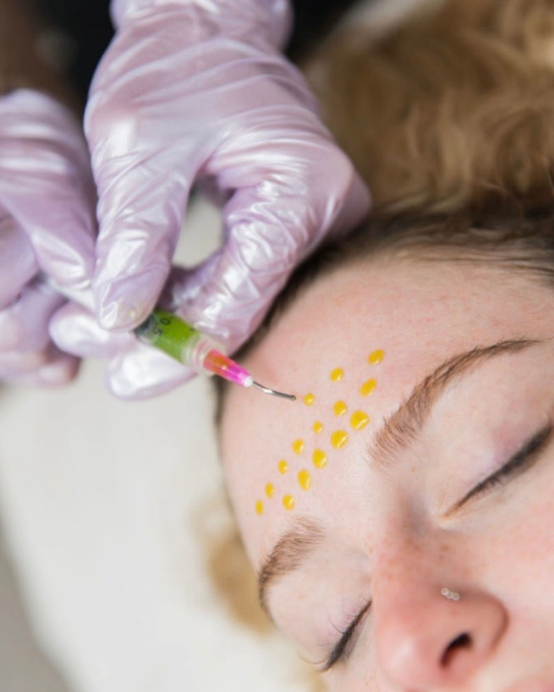 How Does the Treatment Work?