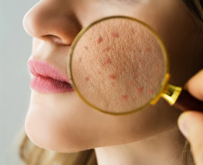 Top  5 Skin Mistakes We See (And What Actually Helps)