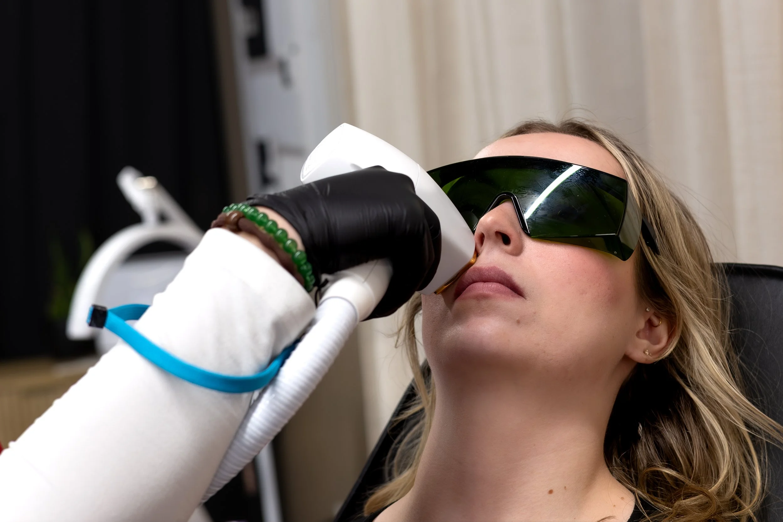 Laser Hair Removal for Upper Lips