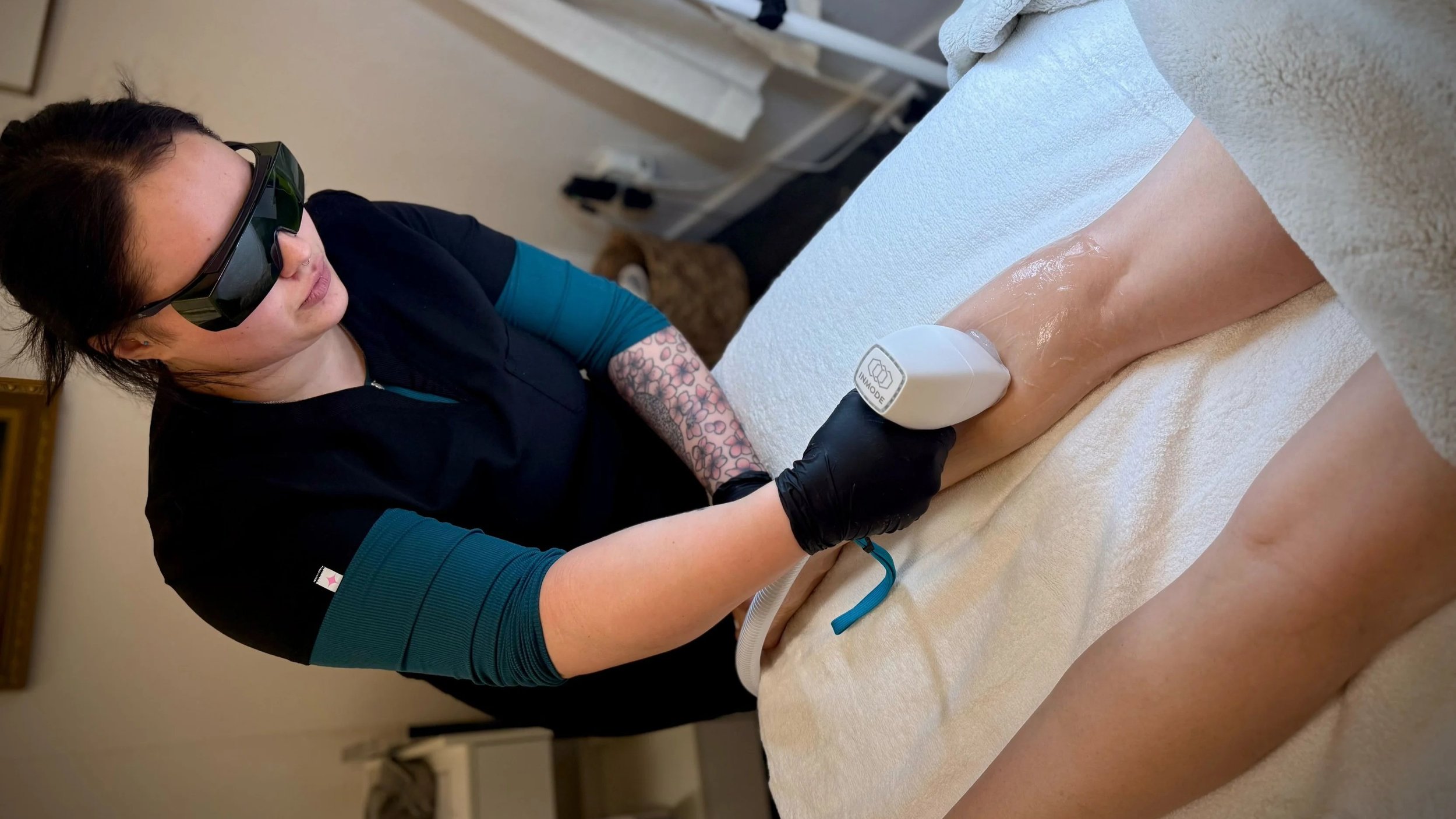 A woman receiving laser hair removal treatment on her leg at a spa or clinic, wearing protective glasses and a black glove on her hand, with a technician using a laser device.