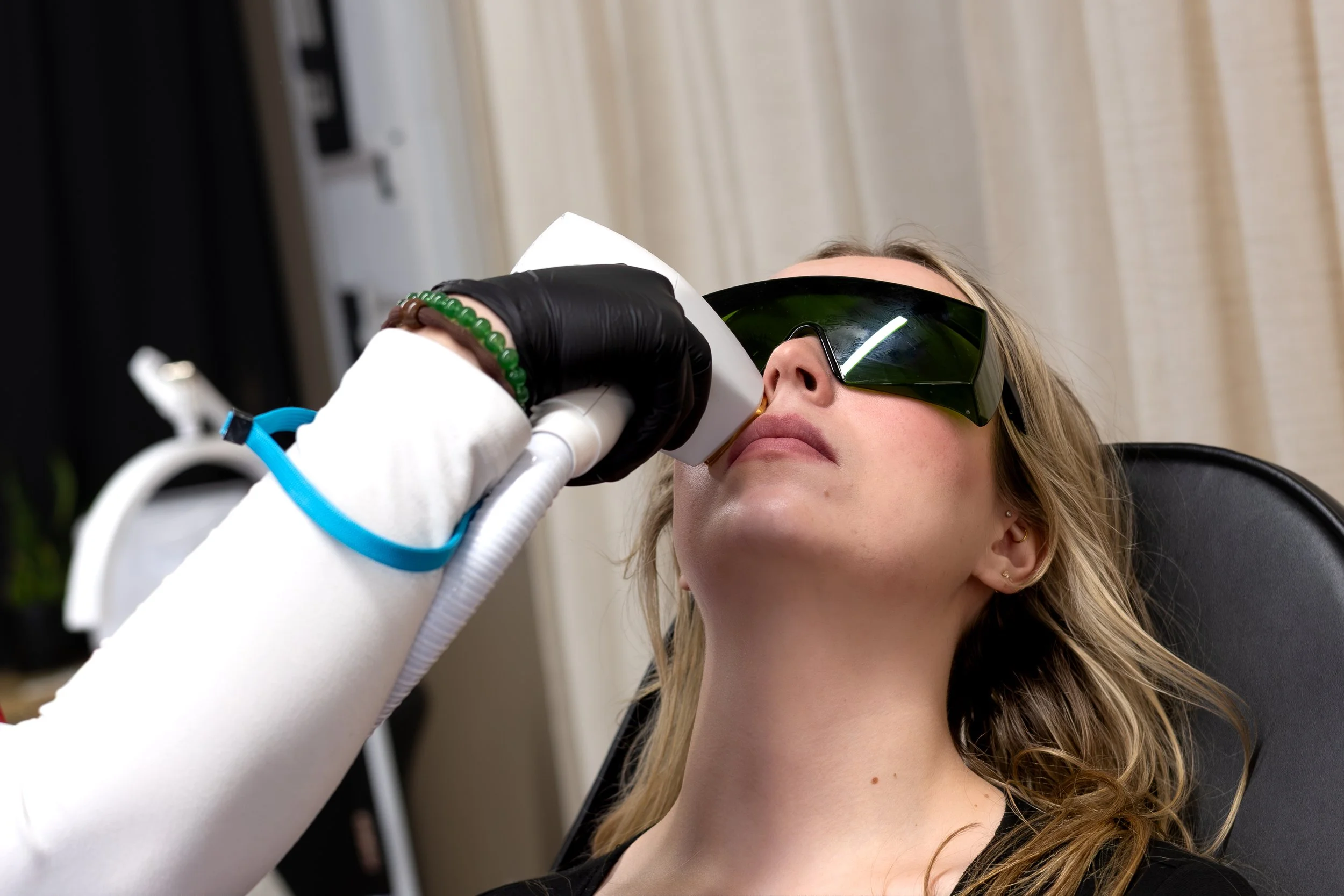 Upper Lip Laser Hair Removal in Helena, MT