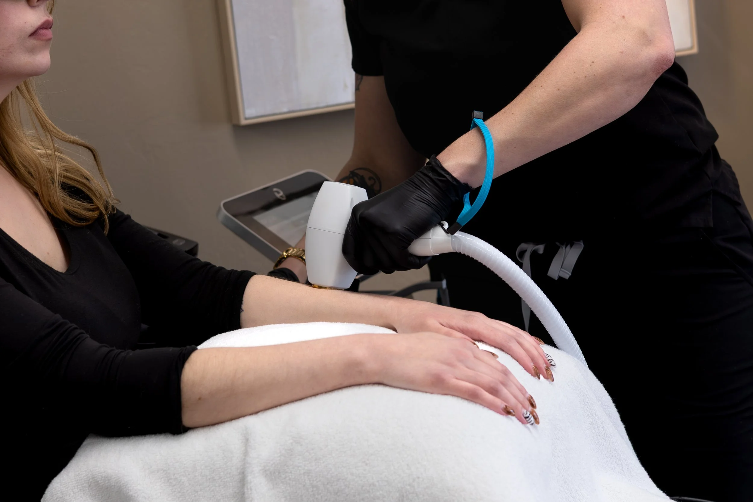 Laser Hair Removal for Upper Arms