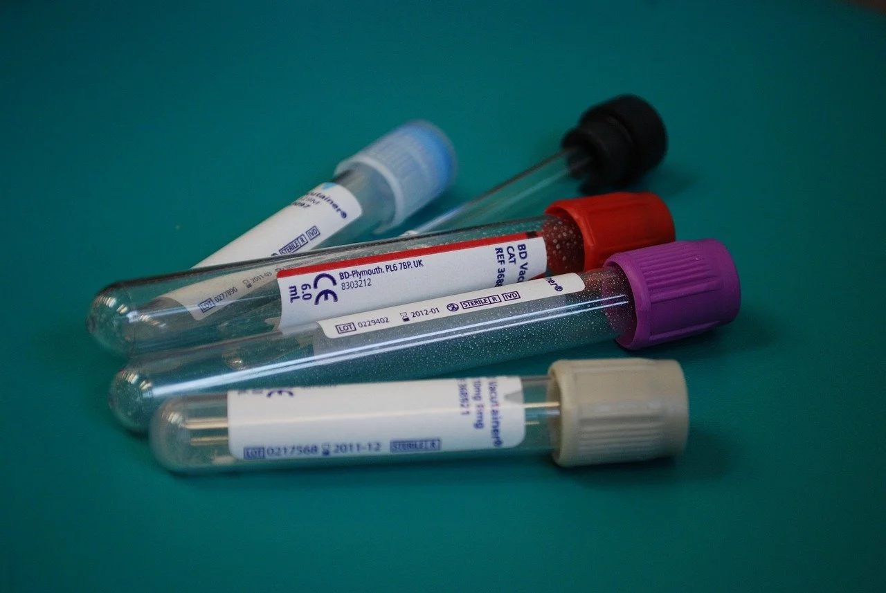Several blood collection test tubes with colored caps on a teal surface.