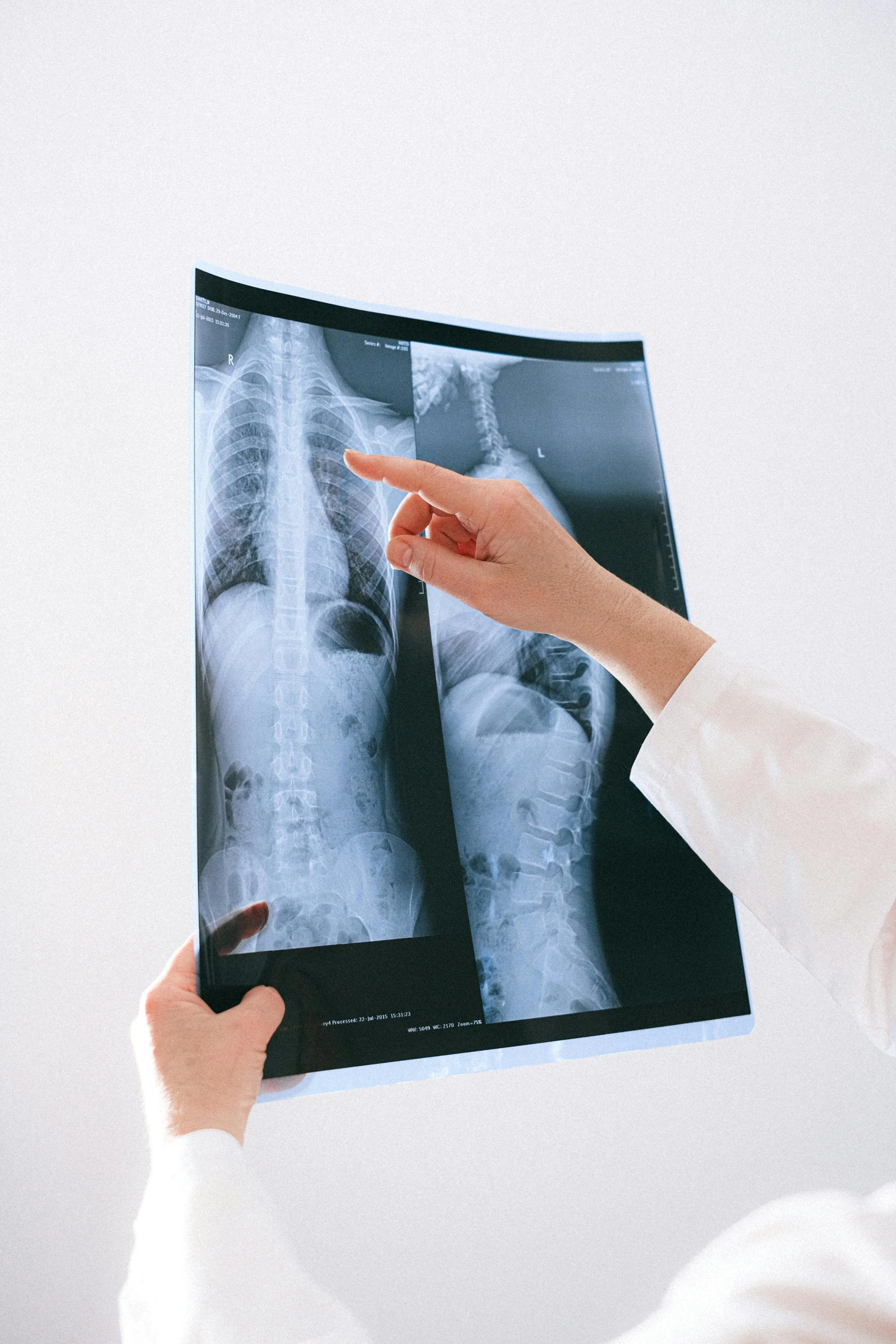 Medical professional examining X-ray images of a human chest and spine.