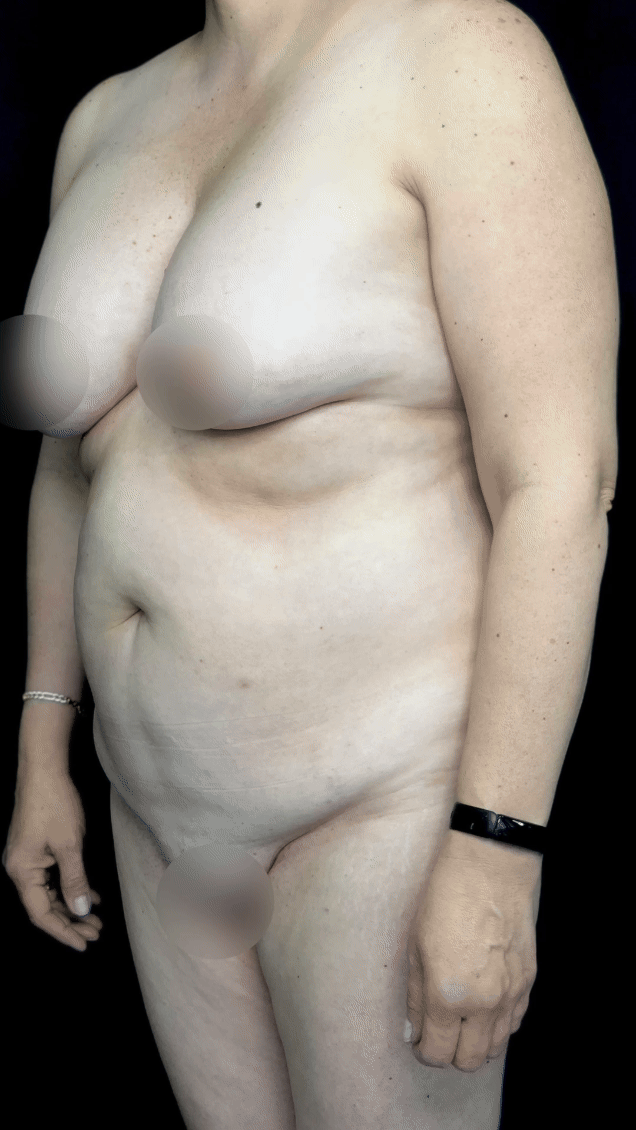 A nude woman standing against a black background, facing slightly to the right, with her face outside the frame. Her breasts and pubic area are censored.