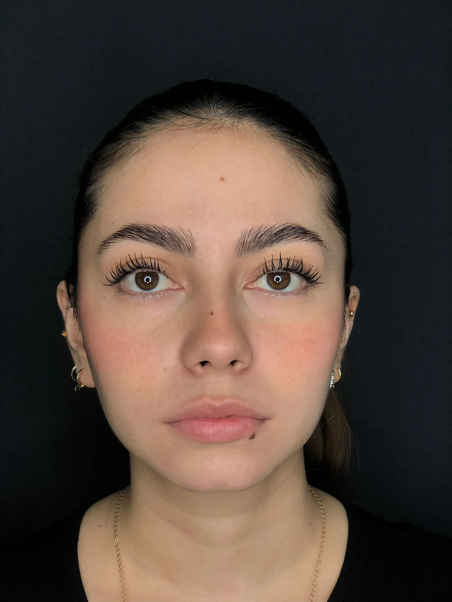 ELI RETIRO DE BICHATS DESPUES.JPG