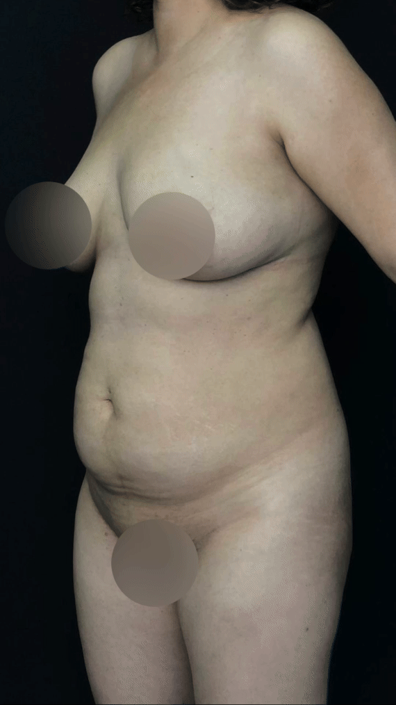 Nude woman with blurred nipples and pubic area, standing against a black background.