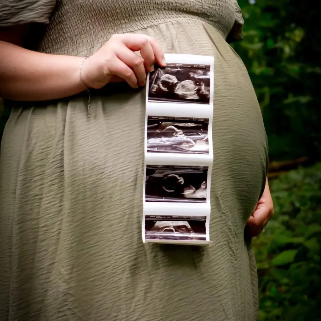 One of the sweetest props you can bring to your maternity shoot?
Your baby&rsquo;s scan photos. 🖤📸

There&rsquo;s something powerful about holding that first glimpse of your baby while waiting to meet them. It ties the whole journey together &mdash