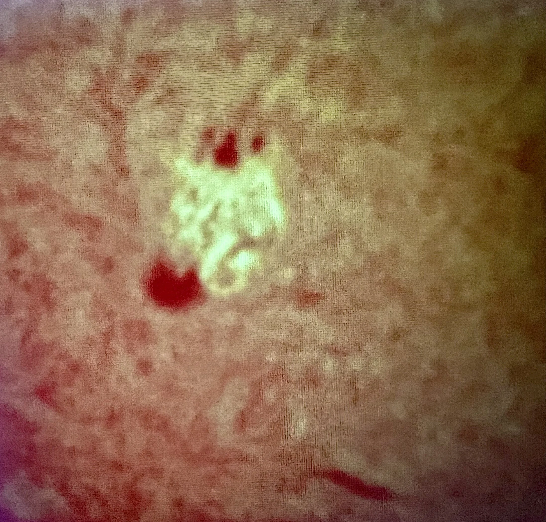 Sunspot Flaring in H-Alpha through Solar Scope