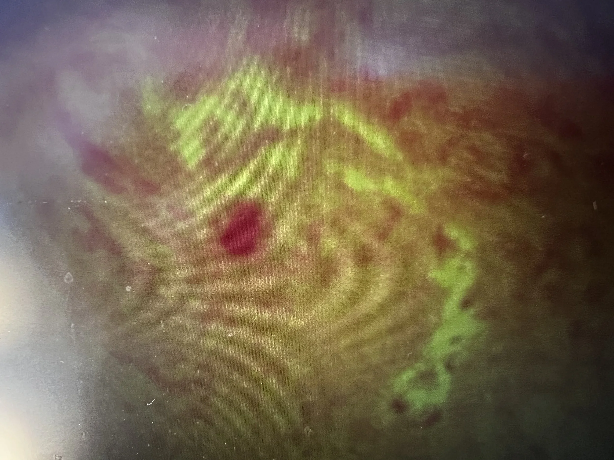 Sunspot dynamics in H-Alpha through Solar Scope
