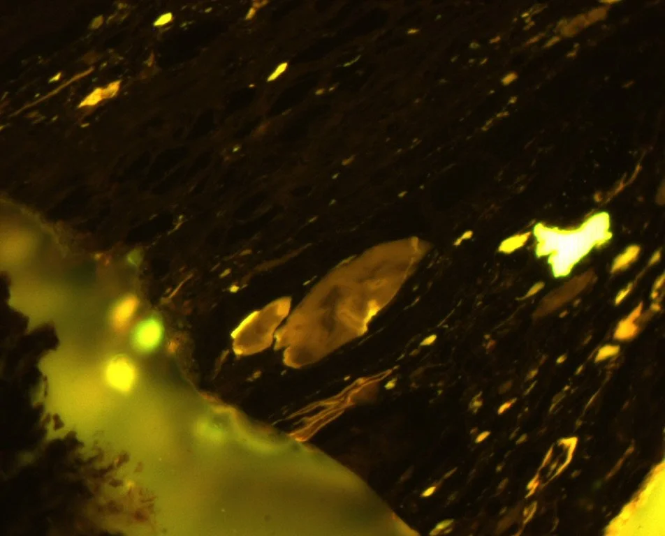 PEN-9-014 Pict 01 General FLUO.JPG