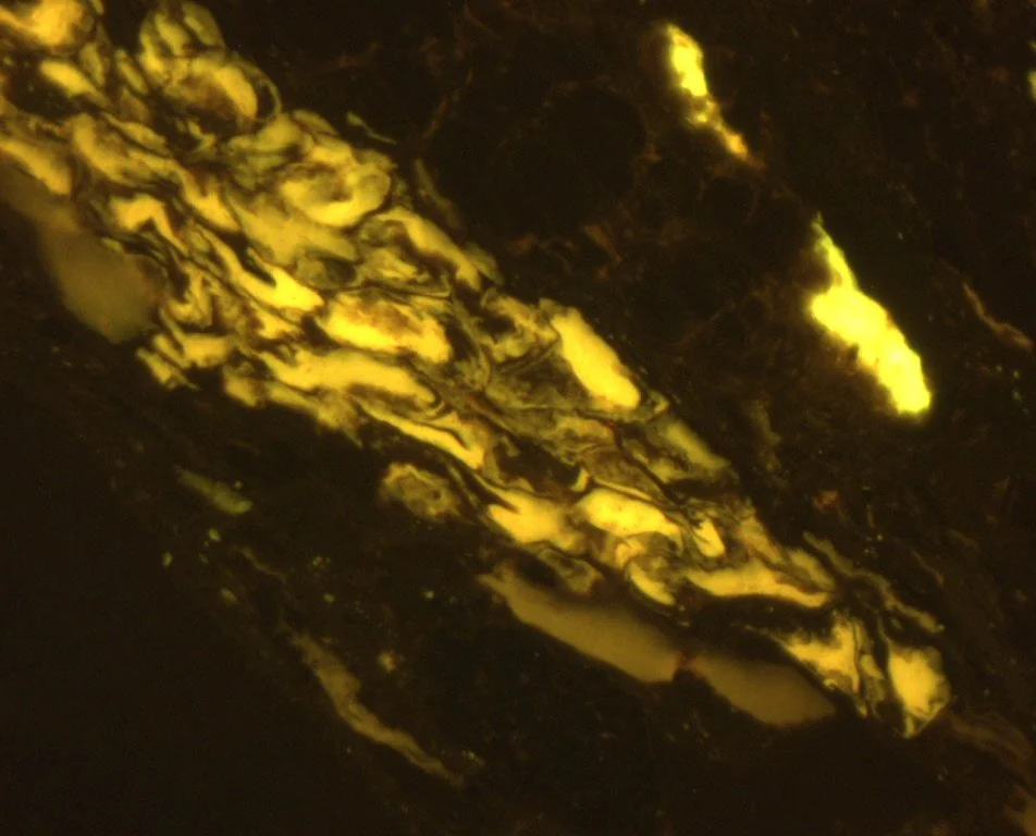 Penh-9-024 Pict 09 res FLUO.JPG