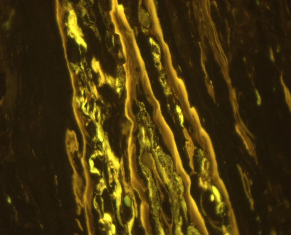 Cutinite (from the liptinite group) representing preserved leaves. Walloon Coal Measures, Surat Basin, Australia. Photomicrograph taken in fluorescent mode.