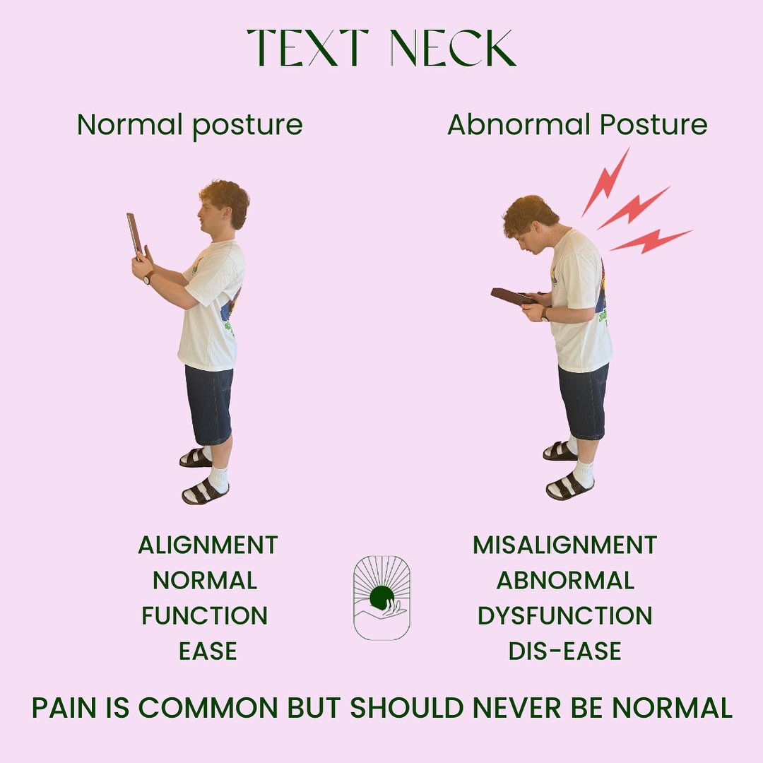 Text neck is a repetitive stress injury caused by prolonged forward head posture while using smartphones, tablets, or computers. 

When the head tilts forward, the weight placed on the cervical spine increases dramatically up to 60 pounds at a 60&deg