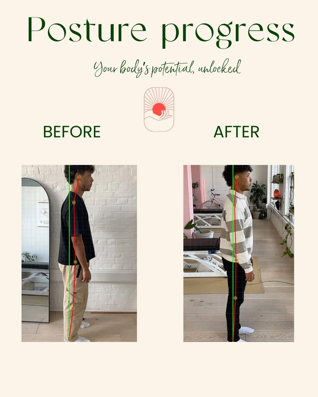 Small shifts big differences 🦴
Before was taken at their initial assessment and the second picture was taken on their 11th review visit 😮
Posture isn’t about standing perfectly straight, it’s about how your body supports you throughou