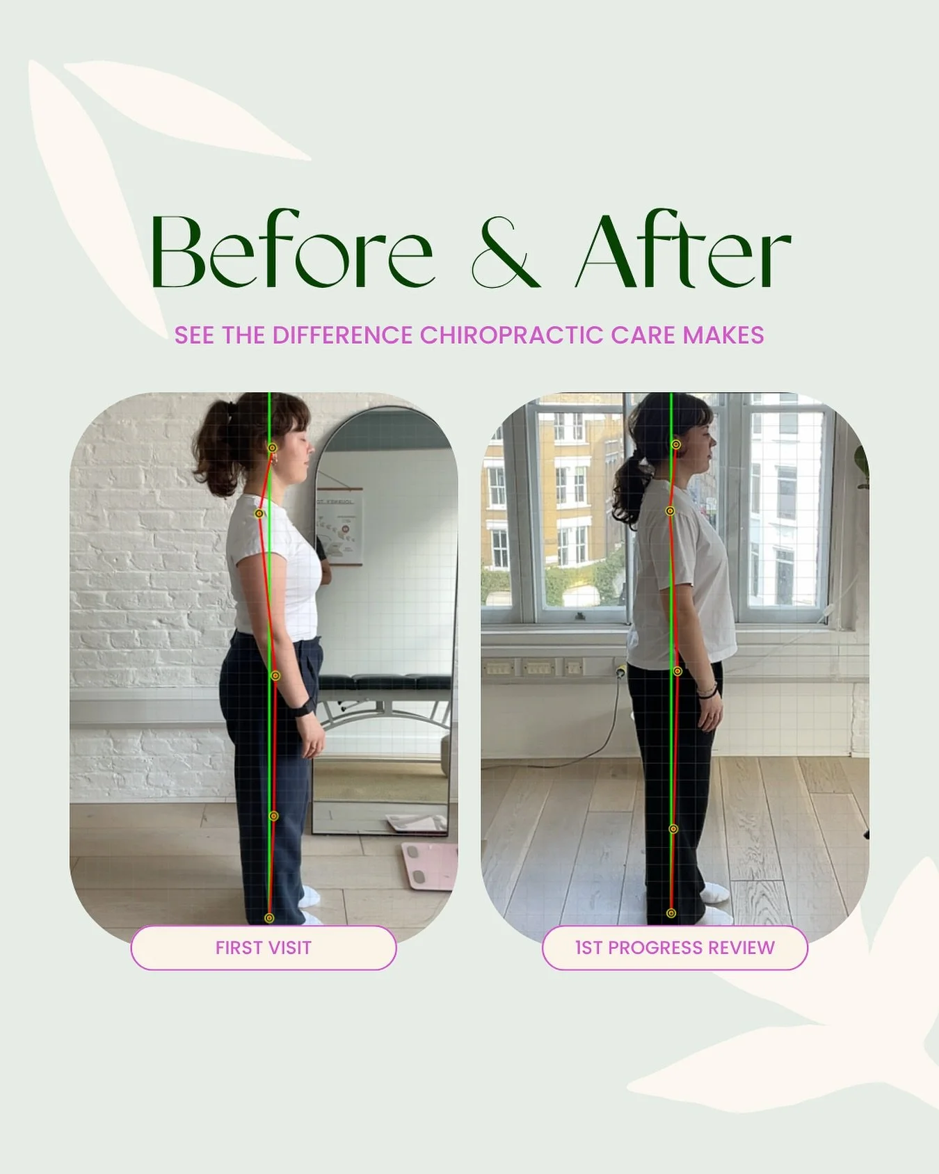 Autumn is here! The jumpers are out, the evenings are darker, and the chill is setting in which means our backs can feel it to 🥶

Chiropractic in the winter months can benefit your posture and help your body function at your best ✨

#londonwellness 