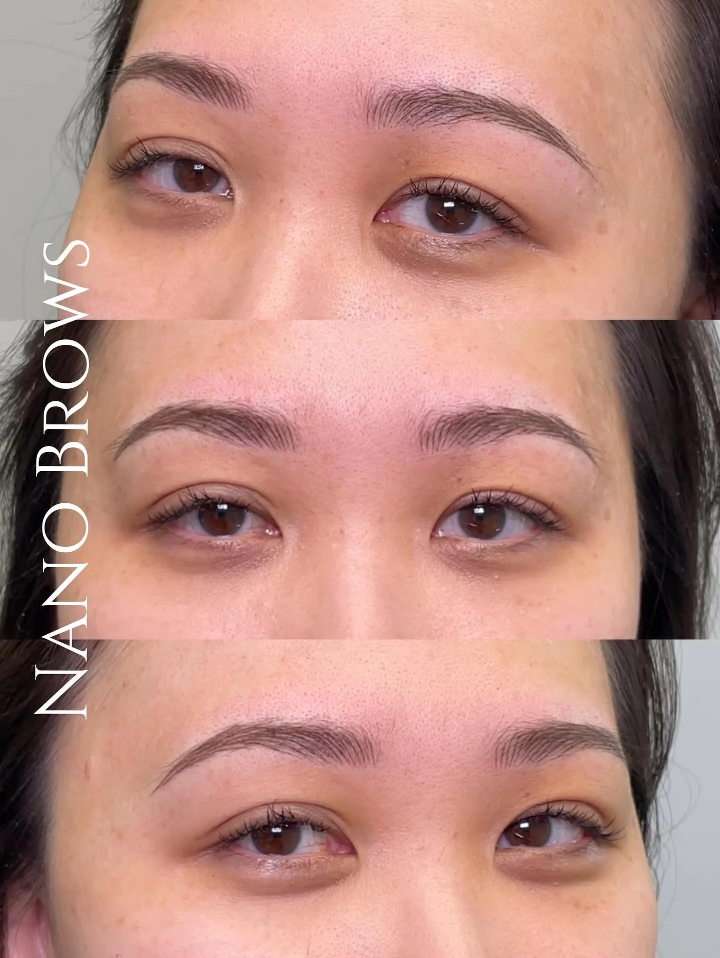 If you have gaps in your brows or simply want a naturally fuller appearance, Nano Brow is the perfect solution for you!

𝗡𝗮𝗻𝗼 𝗕𝗿𝗼𝘄𝘀
💎 Natural Looking Results : Nano brows create realistic, hair-like strokes that mimic the natural brow, resu