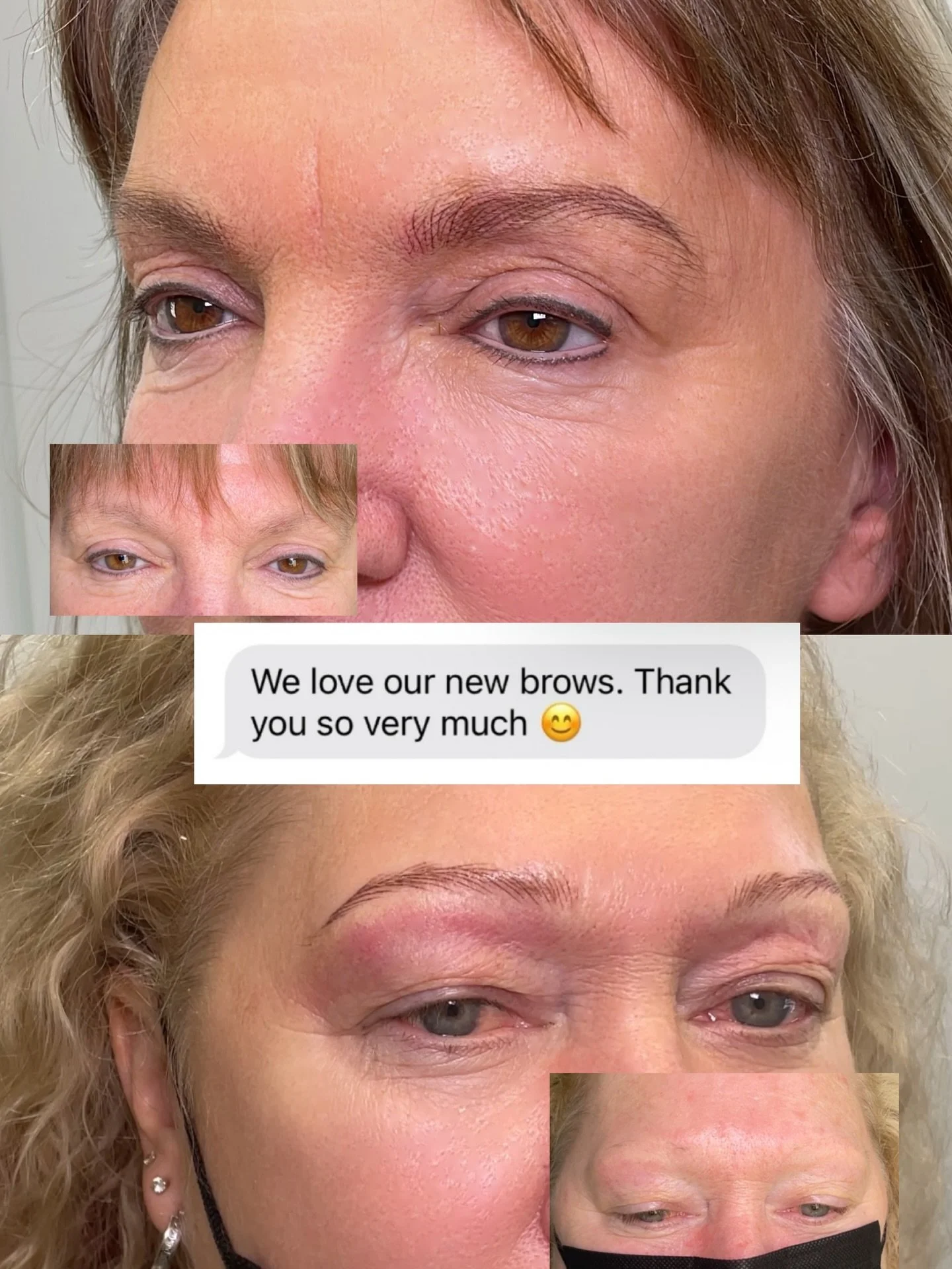 No brows? That&rsquo;s okay. We&rsquo;ll create them for you 🧚&zwj;♀️

𝗡𝗮𝗻𝗼 𝗕𝗿𝗼𝘄𝘀
💎 Natural Looking Results : Nano brows create realistic, hair-like strokes that mimic the natural brow, resulting in a softer, more natural look 
💎 Less tra