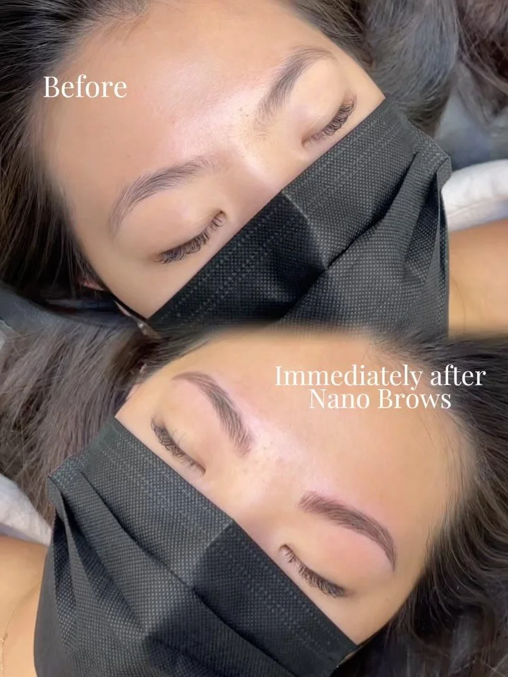 Before and after 𝗡𝗮𝗻𝗼 𝗕𝗿𝗼𝘄𝘀! 
Soft, natural results that blend seamlessly with her natural brow hair ☺️

𝗡𝗮𝗻𝗼 𝗕𝗿𝗼𝘄𝘀
💎 Natural Looking Results : Nano brows create realistic, hair-like strokes that mimic the natural brow, resulting i