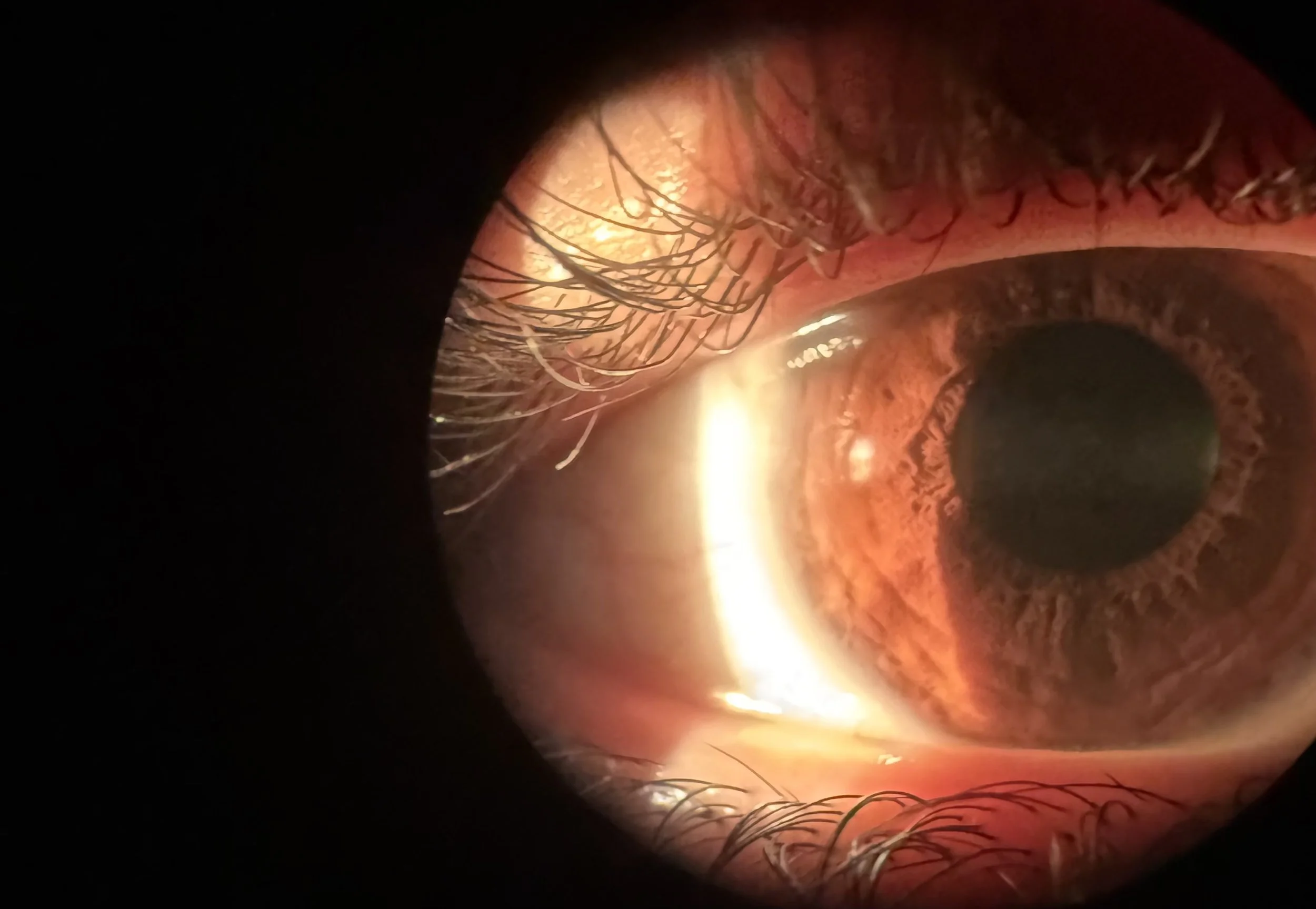 His Creation: Sight (23:78)