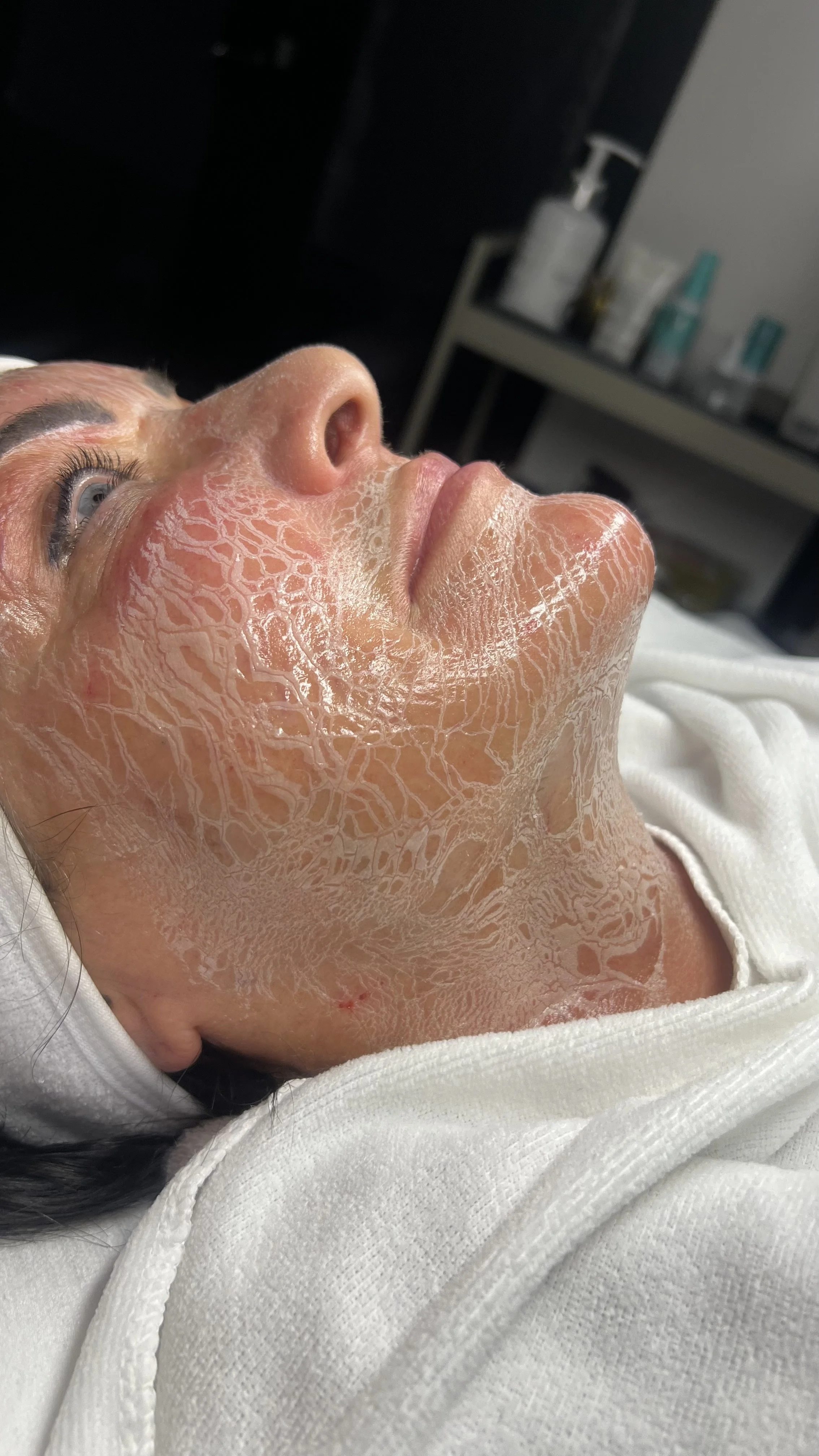 A woman lying on her back with her face and neck covered in a white facial mask, in a skincare or spa treatment setting.